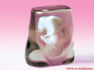 مجسمه سه بعدی جنین