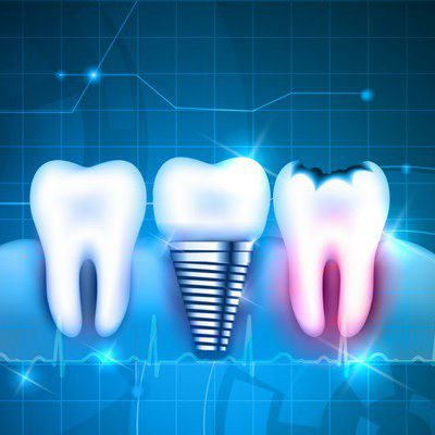 جزوات دندانپزشکی
