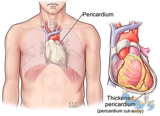 بررسی آناتومیک پریکارد قلب