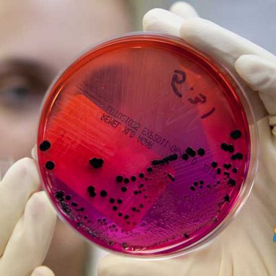 جزوه تشخیص آزمایشگاهی باکتری شناسی