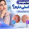از کجا بفهمم زگیل تناسلی دارم؟ علائم آن در مردان و زنان